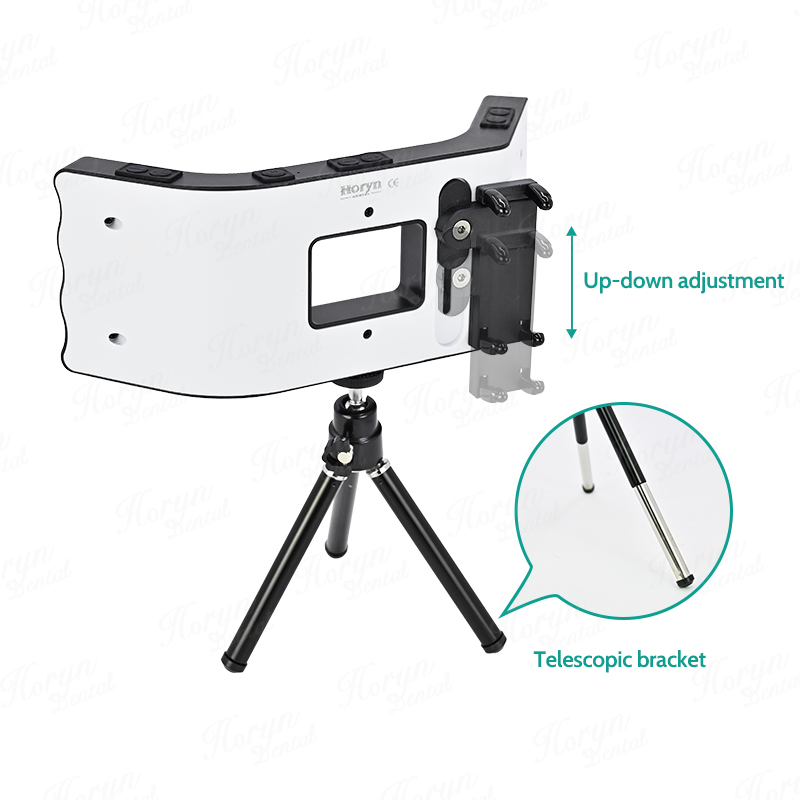 ชุดอุปกรณ์ถ่ายภาพทันตกรรมโทรศั - Photography With Mobile บทวิจารณ์และราคา